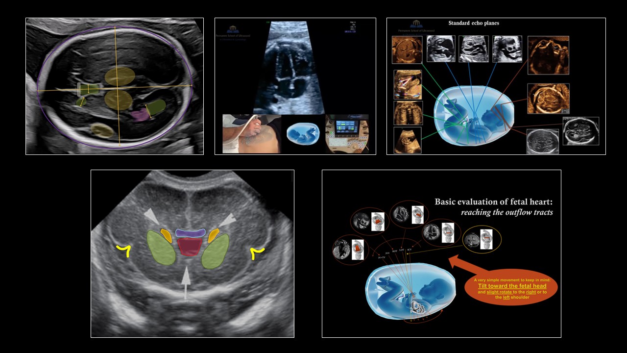 PSUOG — Ultrasound Education in Obstetrics & Gynecology